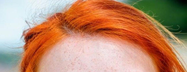 sennik rude włosy